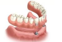 Parkmore Family Dental image 3